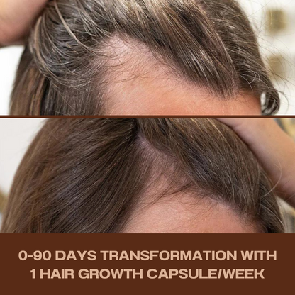 Hair Growth Treatment | Green (30pcs) *Up to 30 weeks